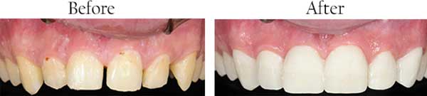 Corrales dental images
